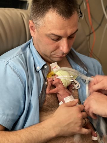 Wcześniak urodzony w 6 miesiącu Wcześniak urodzony w 6 miesiącu